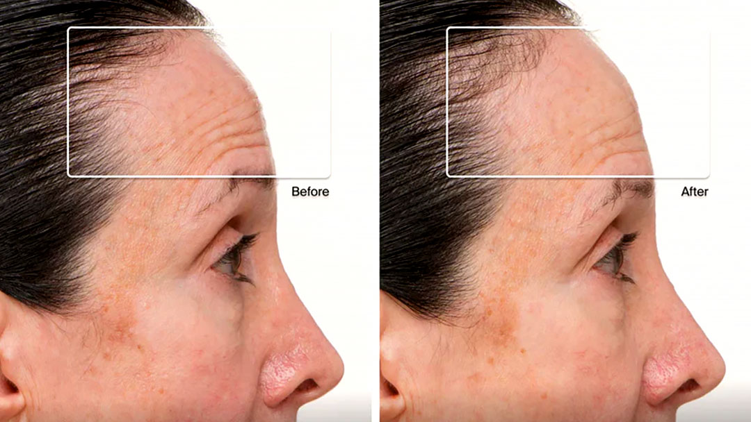Therabody TheraFace Mask Review