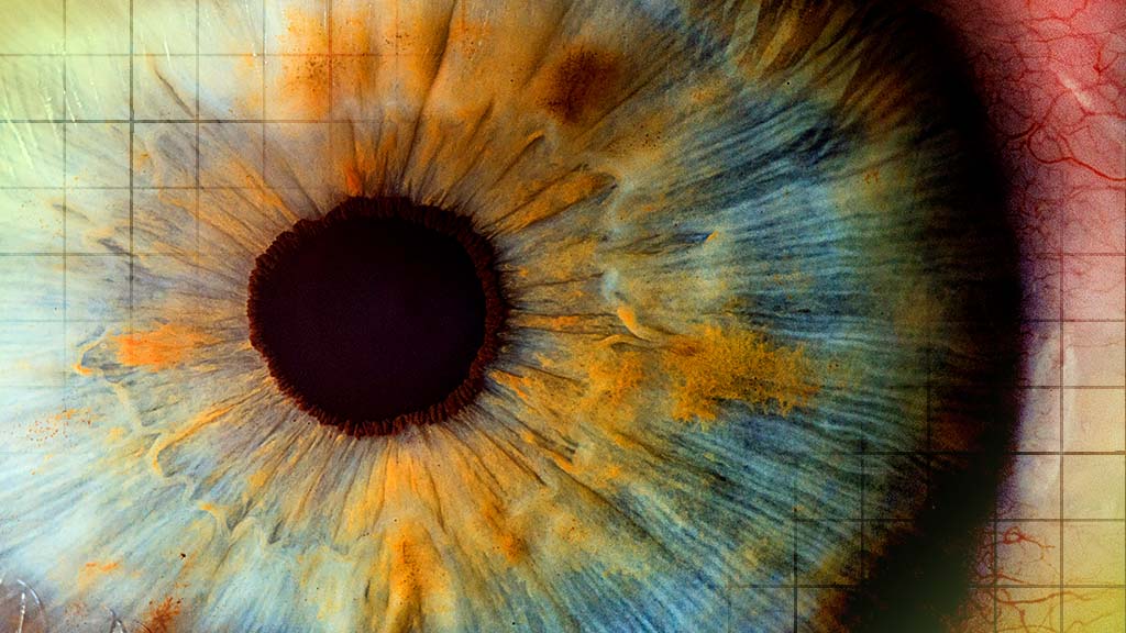 Age-related vision loss is reduced by fatty acid injection therapy