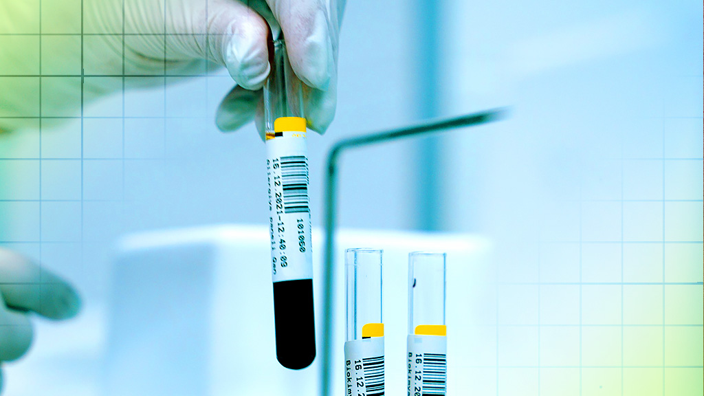 One-time gene therapy significantly lowers "bad" cholesterol