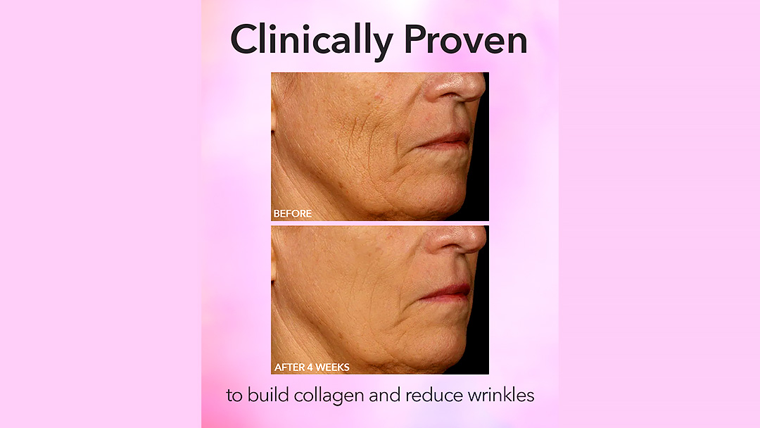 Dr Dennis Gross LED Mask Review
