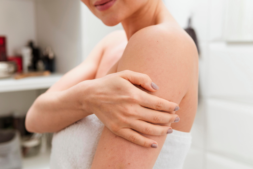 Mounjaro injection sites: a woman with some light bruising on her arm.