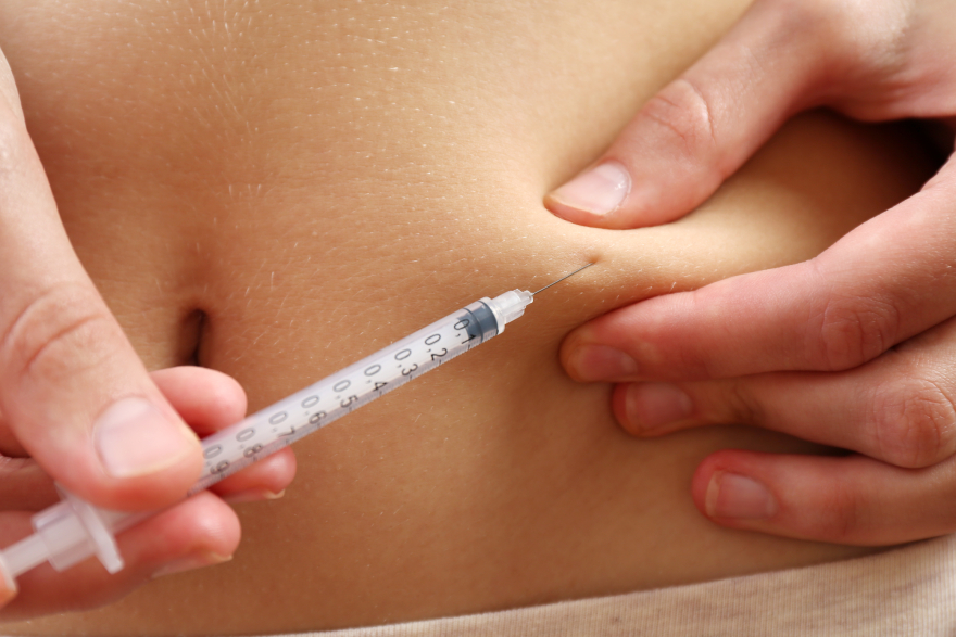 Mounjaro injection sites: a syring used to inject peptides into the abdomen.